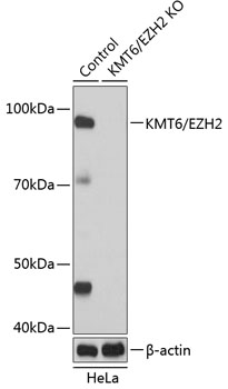 Anti-KMT6 / EZH2 Antibody [KO Validated] (CAB19577)