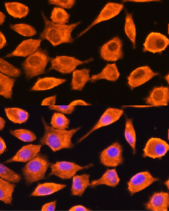 Anti-DTYMK Antibody (CAB6370)