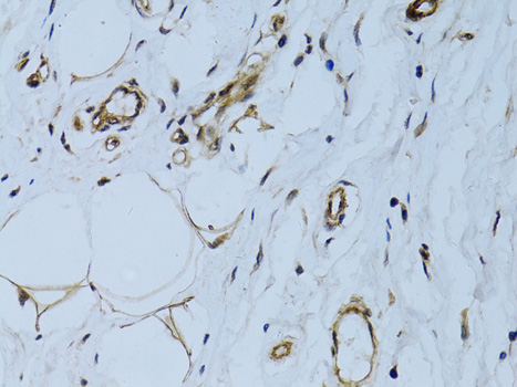 Anti-MCAM Antibody (CAB13927)