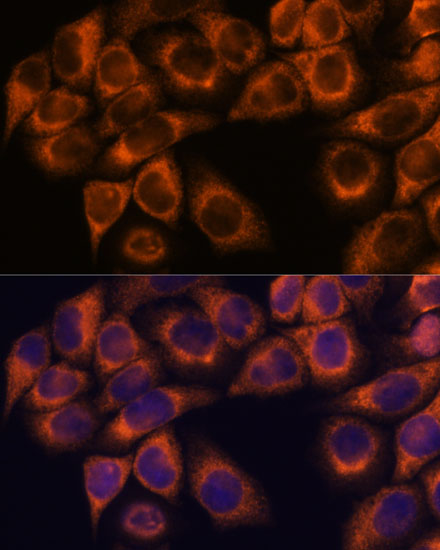 Anti-MMP25 Antibody (CAB3032)