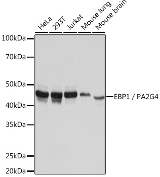 Anti-EBP1 / PA2G4 Antibody (CAB5114)