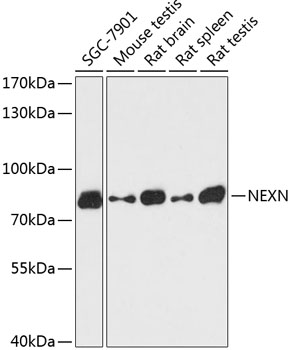 Anti-NEXN Antibody (CAB13136)