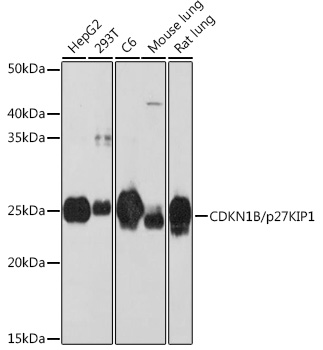 Anti-CDKN1B/p27KIP1 Antibody [KO Validated] (CAB19095)