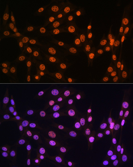 Anti-TARDBP Antibody (CAB13404)