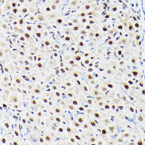 Anti-ACTL6A Antibody (CAB5387)