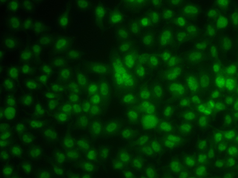 Anti-KLF3 Antibody (CAB7195)