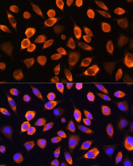 Anti-Hsc70 Antibody (CAB14001)