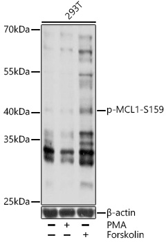 Anti-Phospho-MCL1-S159 Antibody (CABP0947)