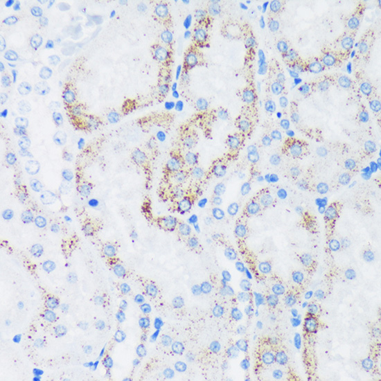 Anti-GTPBP8 Antibody (CAB16189)