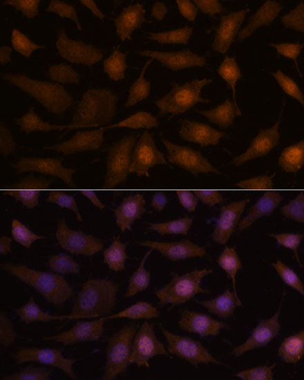 Anti-EEF1E1 Antibody (CAB15357)