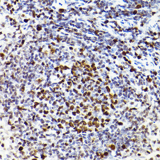 Immunohistochemistry of paraffin-embedded rat spleen using MCM2 Rabbit mAb at dilution of 1:100 (40x lens). Perform high pressure antigen retrieval with 10 mM citrate buffer pH 6. 0 before commencing with IHC staining protocol.