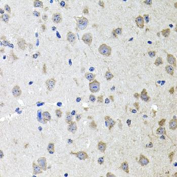 Anti-ALPL Antibody (CAB1080)