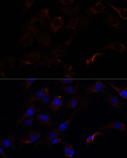 Anti-SEPT8 Antibody (CAB15011)