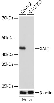 Anti-GALT Antibody [KO Validated] (CAB19903)