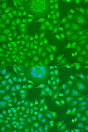 Anti-Cyclin D2 Antibody (CAB1773)