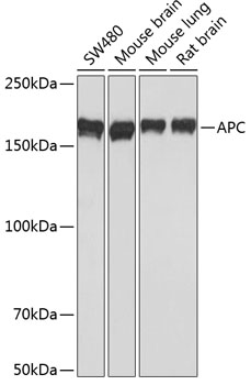 Anti-APC Rabbit Monoclonal Antibody (CAB17912)