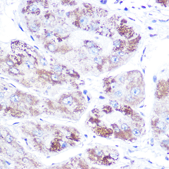 Anti-NR3C2 Antibody (CAB3308)