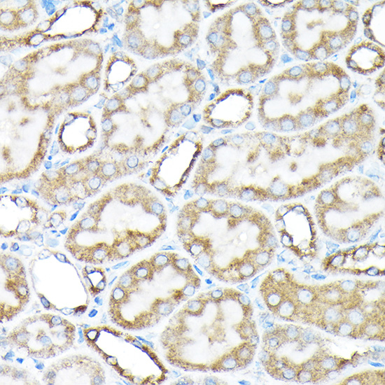 Anti-ETFA Antibody (CAB7670)