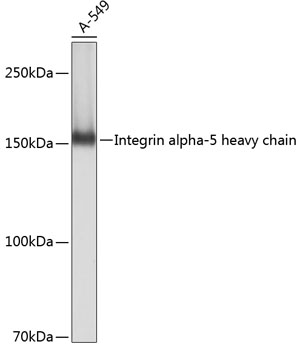 Anti-Integrin alpha 5 Antibody (CAB19069)