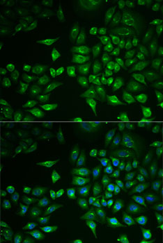 Anti-PLA2G2D Antibody (CAB6690)