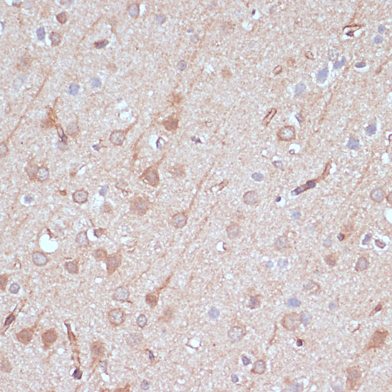 Anti-AK5 Antibody (CAB15424)