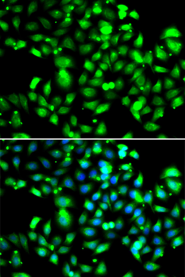 Anti-GBP1 Antibody (CAB6911)