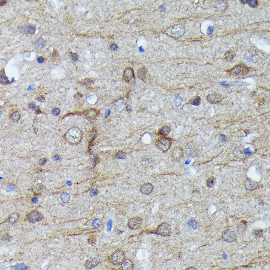 Anti-LC3B Antibody [KO Validated] (CAB19665)