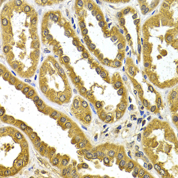 Anti-UGT1A4 Antibody (CAB5549)