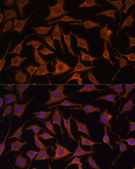 Anti-TNF-Alpha Antibody (CAB11534)