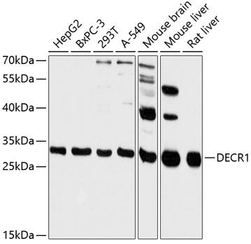 Anti-DECR1 Antibody (CAB13014)