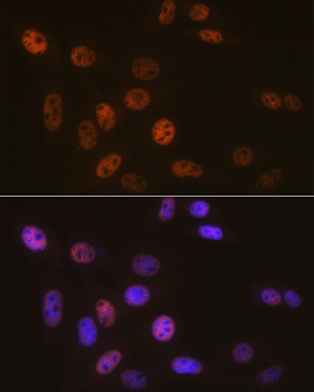 Anti-SNF5 Antibody [KO Validated] (CAB3247)