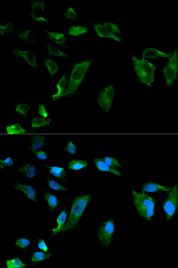 Anti-NEK8 Antibody (CAB0984)