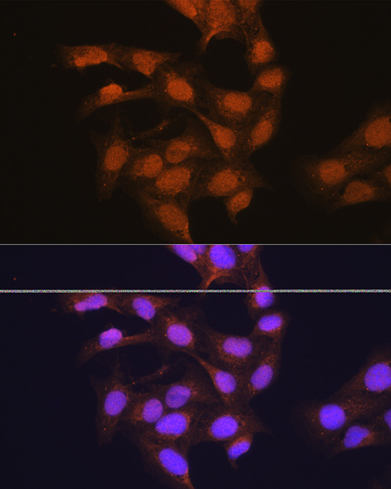 Anti-RPSA Polyclonal Antibody (CAB9008)