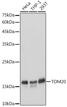 Anti-TOM20 Antibody [KO Validated] (CAB18047)