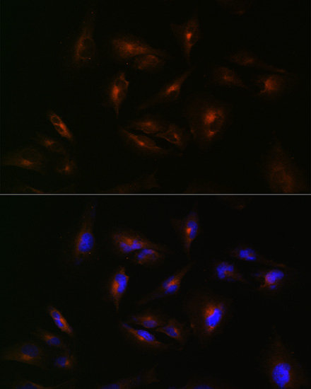 Anti-ABCA2 Antibody (CAB16735)