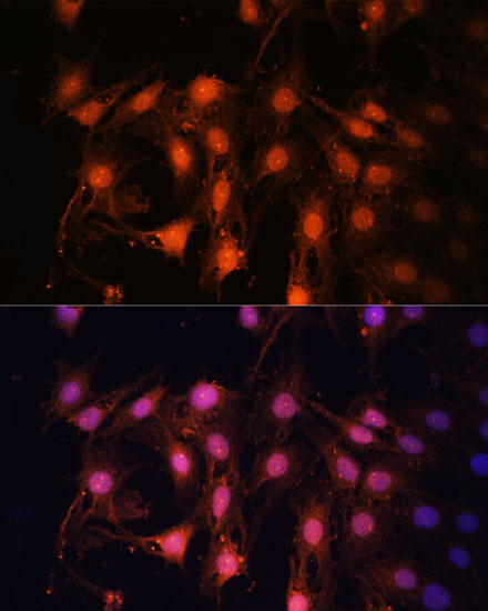 Anti-E2F1 Antibody (CAB2067)