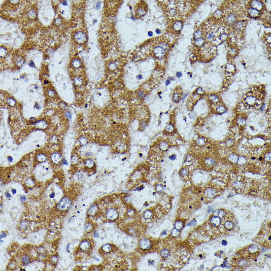 Anti-APOC3 Antibody (CAB1409)