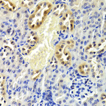 Anti-CDKN1B/p27KIP1 Antibody [KO Validated] (CAB0290)