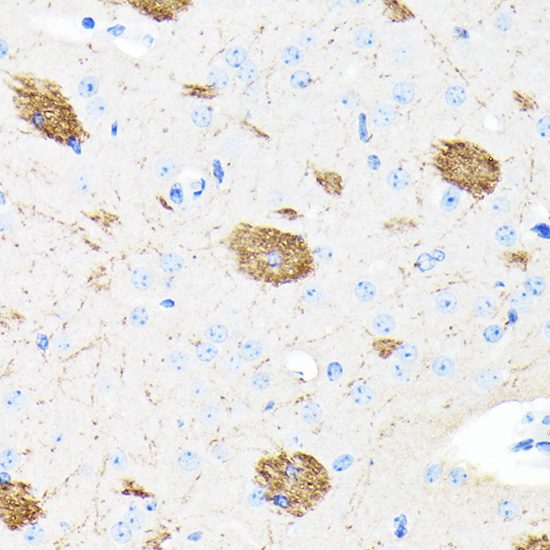 Anti-APP Rabbit Monoclonal Antibody [KO Validated] (CAB17911)