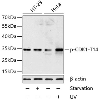 Anti-Phospho-CDK1-T14 Antibody (CABP0015)