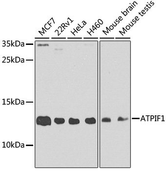 Anti-ATPIF1 Antibody (CAB5099)