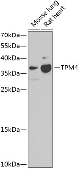 Anti-TPM4 Antibody (CAB4166)