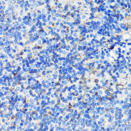 Anti-FLNA Antibody (CAB16376)