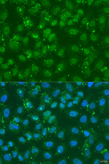 Anti-DGKE Antibody (CAB7752)