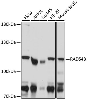 Anti-RAD54B Antibody (CAB16208)