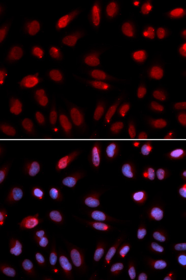 Anti-HUS1 Antibody (CAB5407)