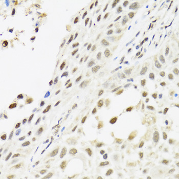 Anti-C14orf166 Antibody (CAB3436)