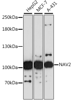 Anti-NAV2 Antibody (CAB16300)