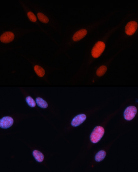 Anti-FOSL2 Antibody (CAB2729)