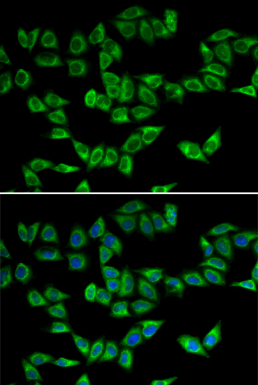 Anti-PRDX5 Antibody (CAB1269)